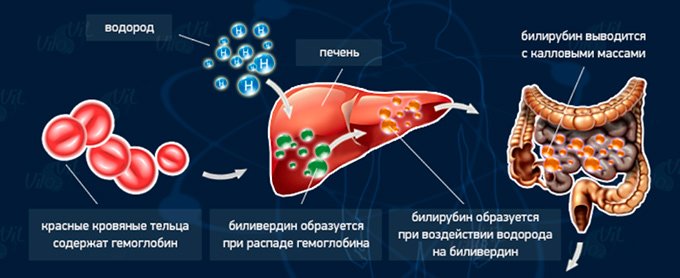 Высокий билирубин у новорожденных по дням: последствия