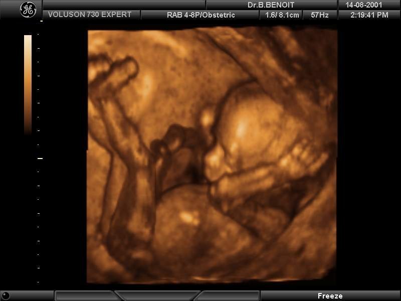 Эмбрион в утробе матери