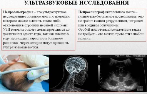Нейросонография