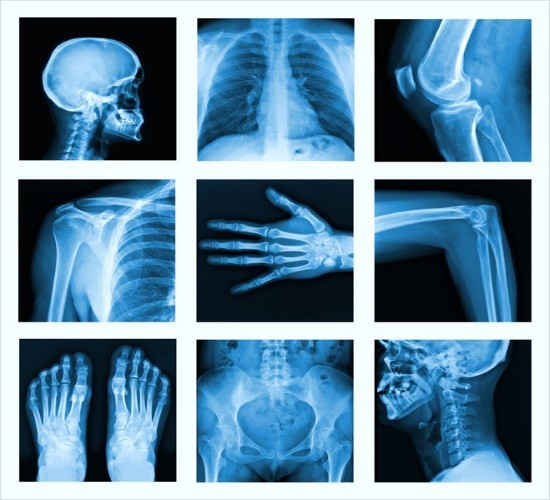 Лучше всего на рентгеновских снимках видны костные ткани