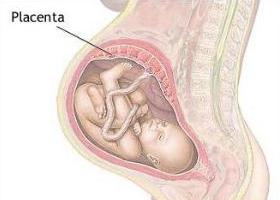низкая плацентация при беременности 20 недель отзывы