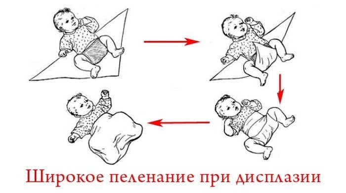 Схема широкого пеленания