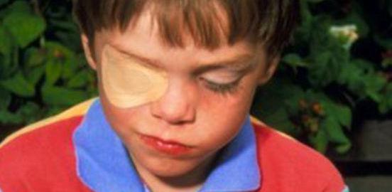 аппаратное лечение глаз у детей