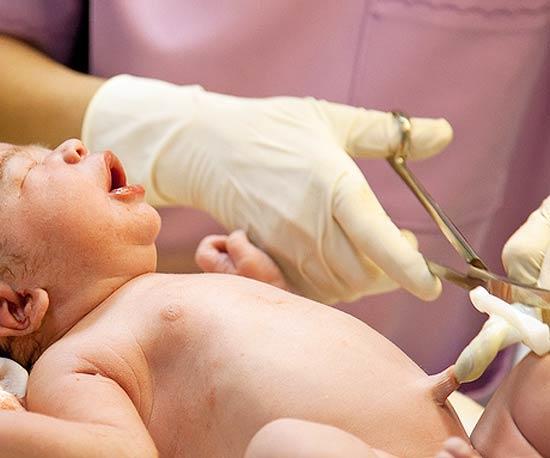 первичная и вторичная обработка пуповины новорожденного