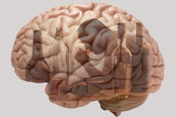 алкогольная патология мозга
