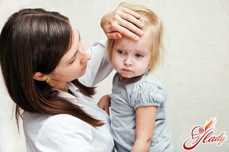 причины сыпи у ребенка на лице
