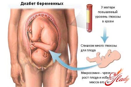 Влияние диабета на плод