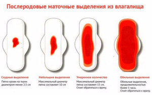 Выделения после родов (лохии): виды