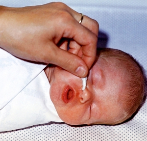 Очистка носовой полости у новорожденного