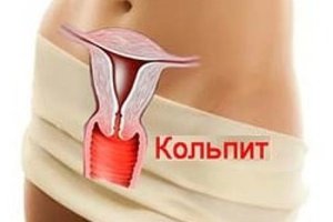 Как вылечить кольпит