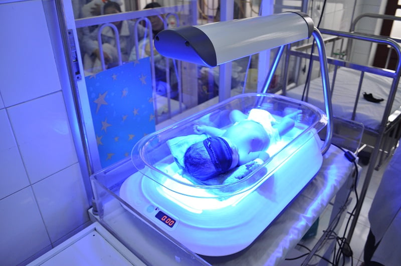 Лечение ядерной желтухи у новорожденных