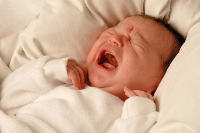 Симптомы ядерной желтухи новорожденных