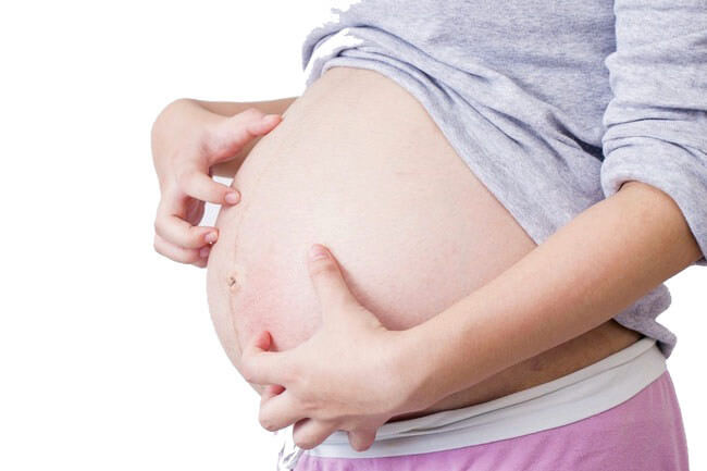 Холестаз беременных