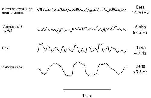 Ритмы мозга, записанные на ЭЭГ