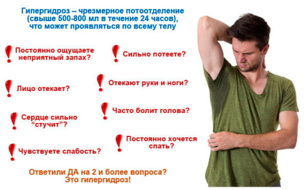 Гипергидроз
