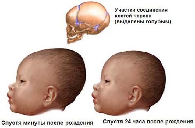 Участки соединения костей черепа