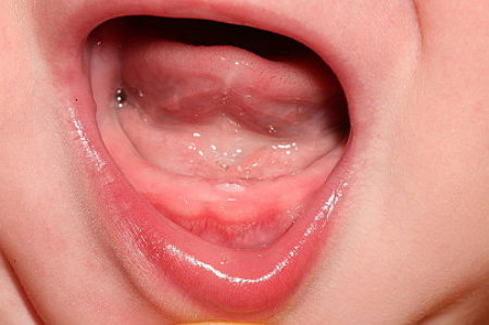 Первый зуб у ребенка