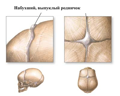 схема