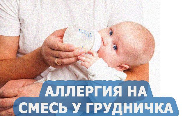 Π°Π»Π»Π΅ΡΠ³ΠΈΡ Π½Π° ΡΠΌΠ΅ΡΡ Ρ Π³ΡΡΠ΄Π½ΠΈΡΠΊΠ° Allergija-na-smes-u-grudnichka