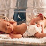 Склерема у новорожденных: признаки, причины, лечени