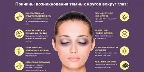 Синяки под глазами причины и лечение. Почему появляется синева под глазами