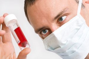 Свертываемость может снижаться как по естественным причинам, так и по причине болезни