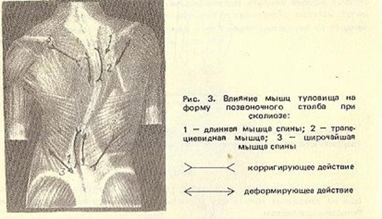 ΠΠ»Π΅ΠΊΡΡΠΎΡΠΎΡΠ΅Π· ΠΏΠΎ ΠΊΠ΅Π»Π»Π°ΡΡ ΡΠ΅Π±Π΅Π½ΠΊΡ