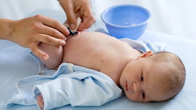 Обработка пупка новорожденного проводится с помощью простых антисептиков