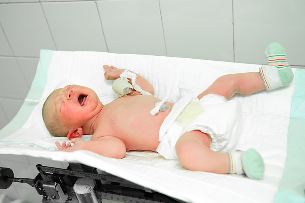 Обработка пупка новорожденного проводится с помощью простых антисептиков