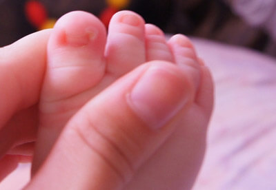 Вросший ноготь у ребенка: лечение медикаме